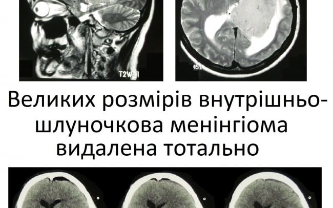 Міжнародний центр нейрохірургії