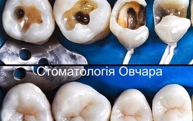 Стоматологічна клініка Овчара